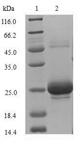 Rat Sclerostin domain-containing protein 1 (Sostdc1) Recombinant Protein, N-10His/C-Myc, aa 24–206, Baculovirus, Rattus norvegicus (Rat), Baculovirus, N-terminal 10xHis-tagged and C-terminal Myc-tagged, 24.6 kDa, purity >≥ 85% as determined by SDS-PAGE.