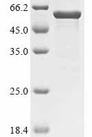 Francisella tularensis subsp. tularensis LPS-assembly protein lptD (lptD), partial Recombinant Protein - BioCrest Sci