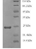Bovine coronavirus Spike glycoprotein (S), partial Recombinant Protein, N-His - BioCrest Sci