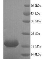 Human Ly6/PLAUR domain-containing protein 6 (LYPD6) Recombinant Protein, N-His - BioCrest Sci