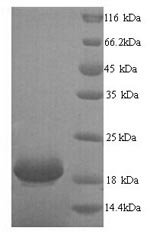 Human Ly6/PLAUR domain-containing protein 6 (LYPD6) Recombinant Protein, N-His, Homo sapiens (Human), Yeast, N-terminal 6xHis-tagged, 18.8 kDa, purity >≥ 90% as determined by SDS-PAGE.