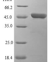 Mouse Heme oxygenase 1 (Hmox1) Recombinant Protein, N-His-B2M - BioCrest Sci