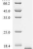 Mycobacterium tuberculosis Antitoxin MT2731 (MT2731) Recombinant Protein - BioCrest Sci