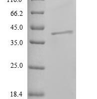 Reston ebolavirus Nucleoprotein (NP), partial Recombinant Protein - BioCrest Sci