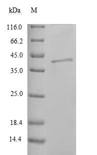 Reston ebolavirus Nucleoprotein (NP), partial Recombinant Protein, Reston ebolavirus (strain Philippines-96) (REBOV) (Reston Ebola virus), E.coli, N-terminal 6xHis-tagged, 41.3 kDa, purity >≥ 90% as determined by SDS-PAGE.