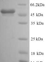 Mouse Glial fibrillary acidic protein (Gfap) Recombinant Protein, N-His, aa 1–430, Yeast - BioCrest Sci