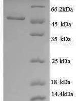 Escherichia coli UDP-glucose 6-dehydrogenase (ugd), partial Recombinant Protein - BioCrest Sci