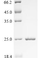 Bovine Odorant-binding protein Recombinant Protein, N-S - BioCrest Sci
