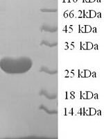 Rat Ephrin-A5 (Efna5) Recombinant Protein, N-His, aa 21–203, Yeast - BioCrest Sci