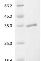 Human Filamin-C (FLNC), partial Recombinant Protein, C-His, aa 1–265, Yeast - BioCrest Sci