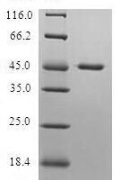 Human Protein Dr1 (DR1) Recombinant Protein - BioCrest Sci