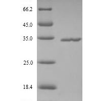 Human Ficolin-2 (FCN2) Recombinant Protein - BioCrest Sci