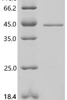 Mouse Ornithine transcarbamylase, mitochondrial (Otc) Recombinant Protein, C-His - BioCrest Sci