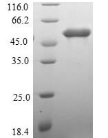 Human Protein MEMO1 (MEMO1) Recombinant Protein - BioCrest Sci