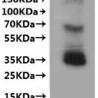 Mouse C-C chemokine receptor type 8 (Ccr8)-VLPs Recombinant Protein - BioCrest Sci
