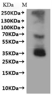 Mouse C-C chemokine receptor type 8 (Ccr8)-VLPs Recombinant Protein, Mus musculus (Mouse), Mammalian cell, C-terminal 10xHis-tagged(This tag can be tested only under denaturing conditions), 42.0 kDa, purity >≥ 95% as determined by SEC-HPLC.