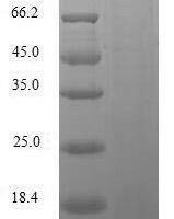 Human Replication factor C subunit 1 (RFC1), partial Recombinant Protein, N-10His/C-Myc, aa 402–492, Baculovirus - BioCrest Sci