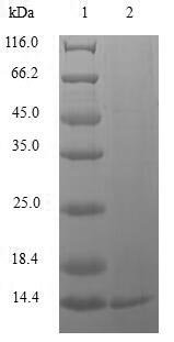 Human Replication factor C subunit 1 (RFC1), partial Recombinant Protein, N-10His/C-Myc, aa 402–492, Baculovirus, Homo sapiens (Human), Baculovirus, N-terminal 10xHis-tagged and C-terminal Myc-tagged, 13.8 kDa, purity >≥ 85% as determined by SDS-PAGE.