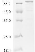 Human Long-chain-fatty-acid--CoA ligase 6 (ACSL6), partial Recombinant Protein - BioCrest Sci