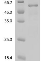 Mouse Perilipin-2 (Plin2) Recombinant Protein, C-His - BioCrest Sci