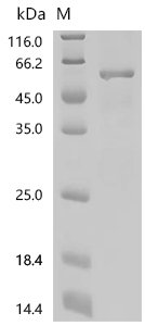 Mouse Perilipin-2 (Plin2) Recombinant Protein, C-His, Mus musculus (Mouse), E.coli, C-terminal 6xHis-tagged, 53.4 kDa, purity >≥ 95% as determined by SDS-PAGE.
