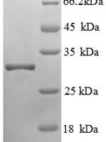 Human  Glutamyl aminopeptidase (ENPEP), partial Recombinant Protein - BioCrest Sci