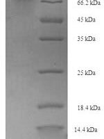 Escherichia coli Phosphoenolpyruvate synthase (ppsA) Recombinant Protein - BioCrest Sci