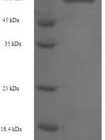 Human Hexokinase-1 (HK1), partial Recombinant Protein, N-His-SUMO - BioCrest Sci