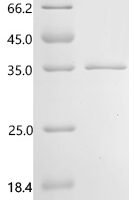Human Norrin (NDP) Recombinant Protein, N-His-SUMO - BioCrest Sci