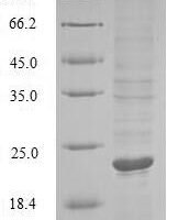 Marmota monax Tumor necrosis factor (TNF), partial Recombinant Protein, N-10His - BioCrest Sci
