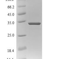 Bovine Protein S100-A9 (S100A9) Recombinant Protein - BioCrest Sci