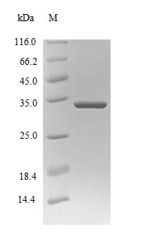 Bovine Protein S100-A9 (S100A9) Recombinant Protein, Bos taurus (Bovine), E.coli, N-terminal 10xHis-B2M-tagged and C-terminal Myc-tagged, 34.0 kDa, purity >≥ 85% as determined by SDS-PAGE.