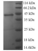 Human Nucleoside diphosphate kinase A (NME1) Recombinant Protein - BioCrest Sci