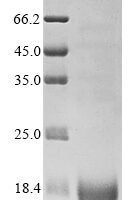 Human Phospholipid phosphatase-related protein type 2 (PLPPR2), partial Recombinant Protein, N-His - BioCrest Sci