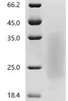 Macaca fascicularis B and T lymphocyte associated (BTLA), partial Recombinant Protein - BioCrest Sci