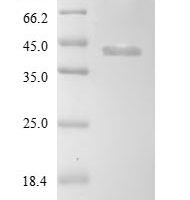 Borrelia burgdorferi ATP-dependent Clp protease proteolytic subunit 2 (clpP2) Recombinant Protein, N-10His-SUMO/C-Myc - BioCrest Sci