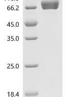 Human Galectin-9(LGALS9), partial, Biotinylated Recombinant Protein - BioCrest Sci