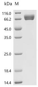 Human Galectin-9(LGALS9), partial, Biotinylated Recombinant Protein, Homo sapiens (Human), Mammalian cell, N-terminal hFc1-Avi-tagged, 63.6 kDa, purity >≥ 90% as determined by SDS-PAGE.≥ 95% as determined by SEC-HPLC.
