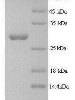 Streptomyces actuosus Nosiheptide precursor (nosM) Recombinant Protein, N-GST, aa 1–50, Yeast - BioCrest Sci
