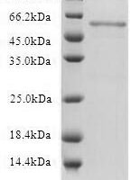 Human 5-hydroxytryptamine receptor 1B (HTR1B) Recombinant Protein - BioCrest Sci