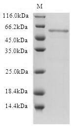 Human 5-hydroxytryptamine receptor 1B (HTR1B) Recombinant Protein, Homo sapiens (Human), in vitro E.coli expression system, N-terminal 10xHis-SUMO-tagged, 62.1 kDa, purity >≥ 90% as determined by SDS-PAGE.