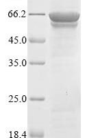 Crimean-Congo hemorrhagic fever virus Nucleoprotein (N) Recombinant Protein, N-His-B2M - BioCrest Sci