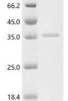 Human CMRF35-like molecule 5 (CD300LD), partial, Biotinylated Recombinant Protein - BioCrest Sci