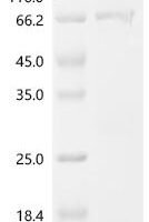 Mouse Pituitary homeobox 3 (Pitx3) Recombinant Protein, C-GST - BioCrest Sci