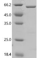 Rat UDP-glucuronosyltransferase 2B7 (Ugt2b7), partial Recombinant Protein - BioCrest Sci