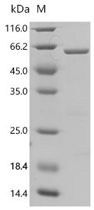 Rat UDP-glucuronosyltransferase 2B7 (Ugt2b7), partial Recombinant Protein, Rattus norvegicus (Rat), E.coli, C-terminal 6xHis-tagged, 61.1 kDa, purity >≥ 90% as determined by SDS-PAGE.