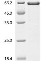 Human Angio-associated migratory cell protein (AAMP) Recombinant Protein - BioCrest Sci