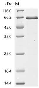 Human Angio-associated migratory cell protein (AAMP) Recombinant Protein, Homo sapiens (Human), E.coli, C-terminal 6xHis-tagged, 53.7 kDa, purity >≥ 85% as determined by SDS-PAGE.