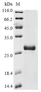 Human Guanylate cyclase soluble subunit alpha-2 (GUCY1A2), partial Recombinant Protein, Homo sapiens (Human), E.coli, N-terminal 6xHis-tagged, 27.8 kDa, purity >≥ 85% as determined by SDS-PAGE.