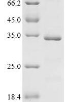 Human Protein Mis18-alpha (MIS18A) Recombinant Protein - BioCrest Sci